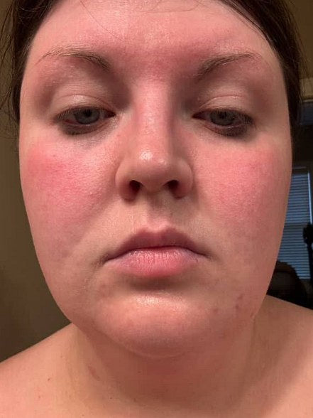 Kayla, verified buyer, Before