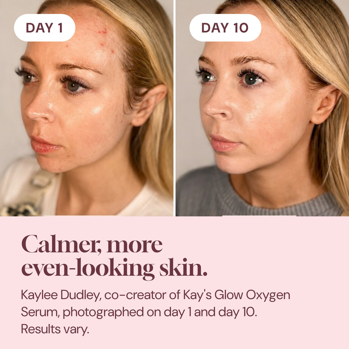 Kaylee Dudley, co-creator, photographed on day 1 and day 10. Results vary.