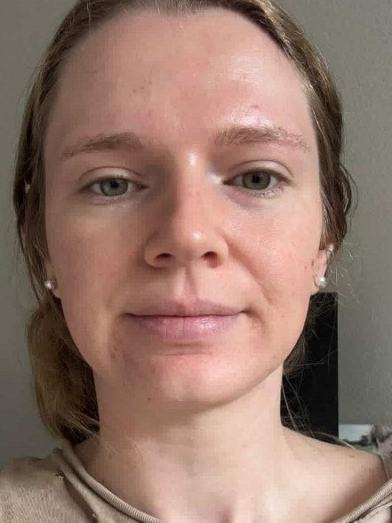 Becca, verified buyer, After · 1 month