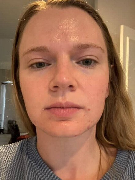 Becca, verified buyer, Before