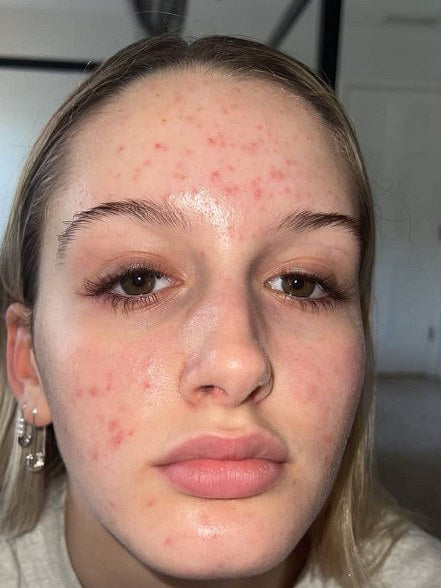 Grace, verified buyer, Before