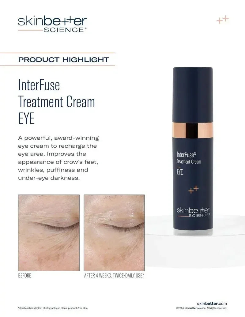skinbetter InterFuse Treatment Cream Eye graphic: bottle beside an eye-area before-and-after photo labelled 4 weeks.